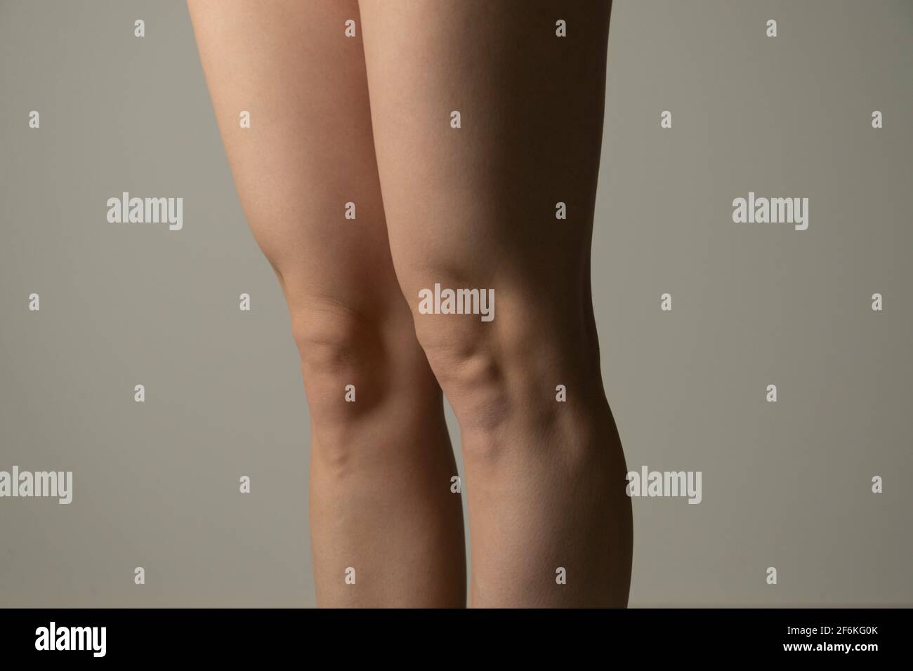 Fat legs and hips, side view. Woman`s hips closeup raw studio shot in